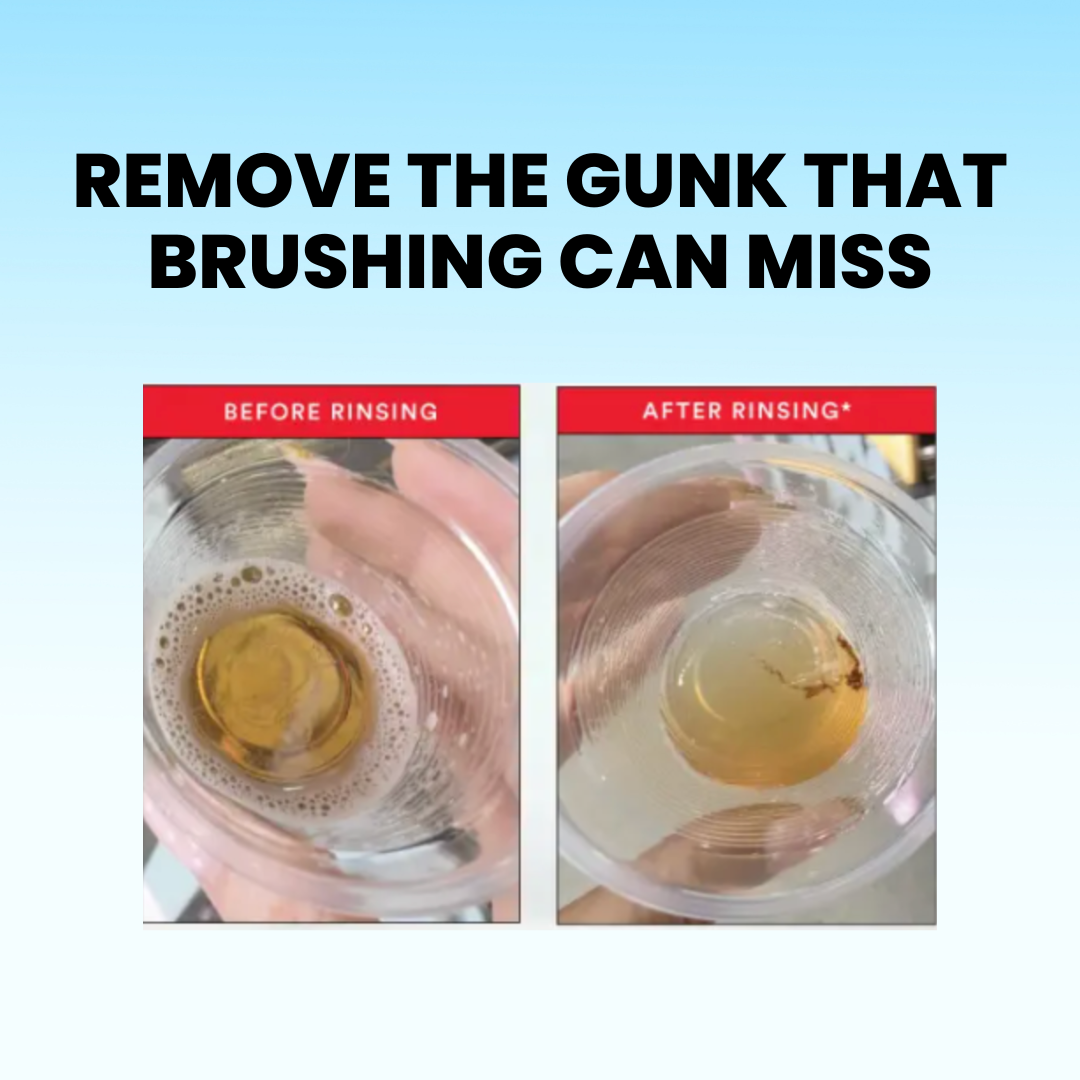 HiSmile ID Stain Whitening Mouthwash
