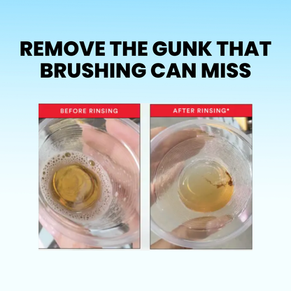 HiSmile ID Stain Whitening Mouthwash