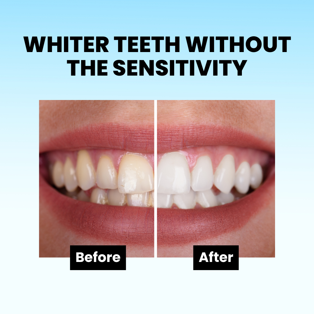 HiSmile ID Stain Whitening Mouthwash
