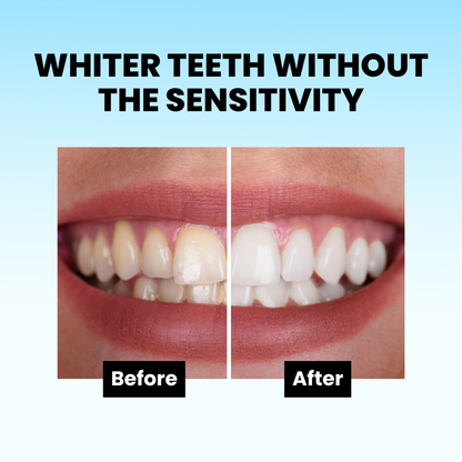 HiSmile ID Stain Whitening Mouthwash